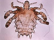 190px-Pthius_pubis_-_crab_louse.jpg