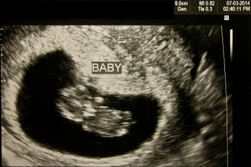 Baby Sonogram Private.jpg