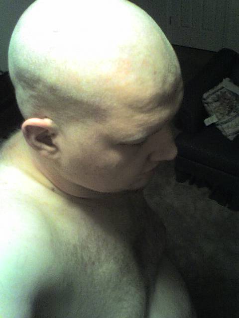 baldtop.jpg