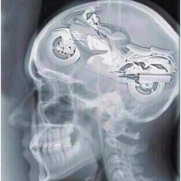 busa brain.png