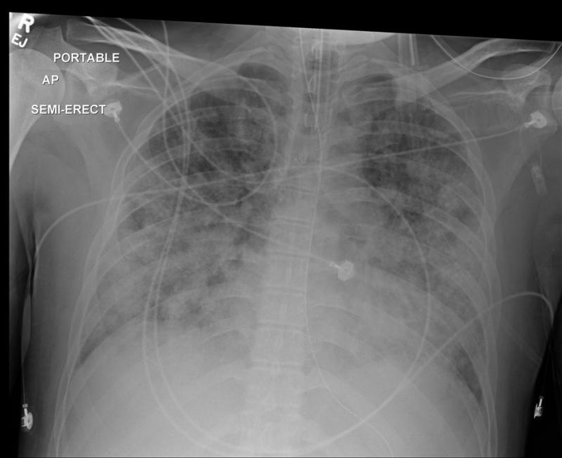 chest (Medium).jpg