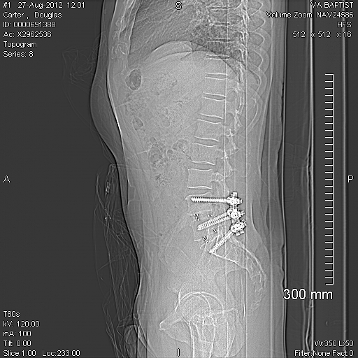 EXP0369 Back screws.jpg