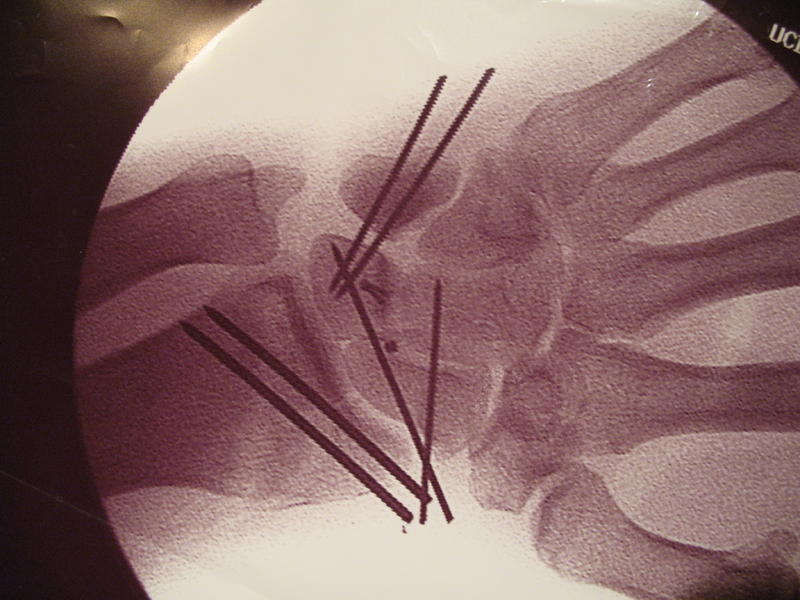 flowers + xrays 090.jpg