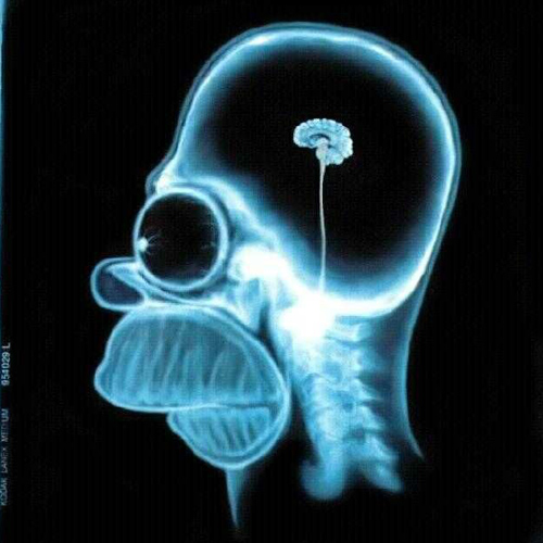 homer_simpson_xray2.jpg