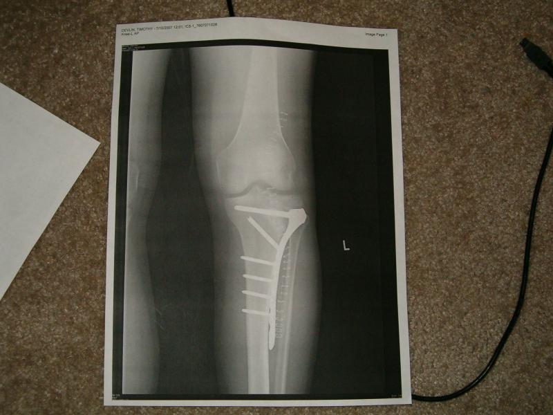 kneerepair 001.jpg