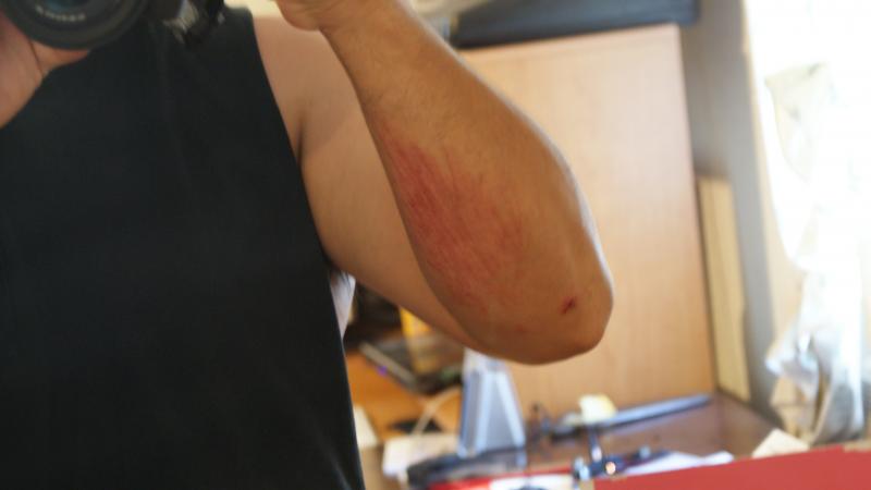 right arm1.jpg