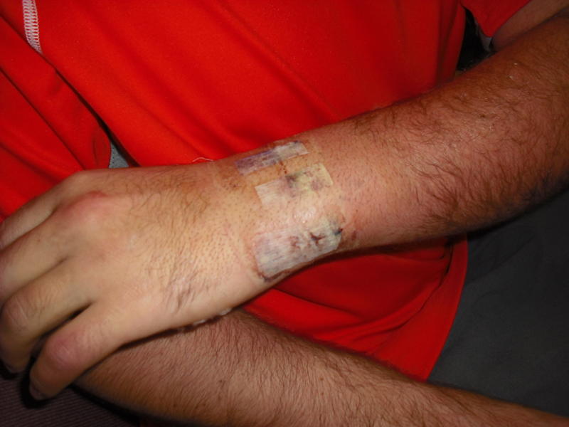 surgery pics 008.jpg