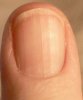 fingernail.jpg